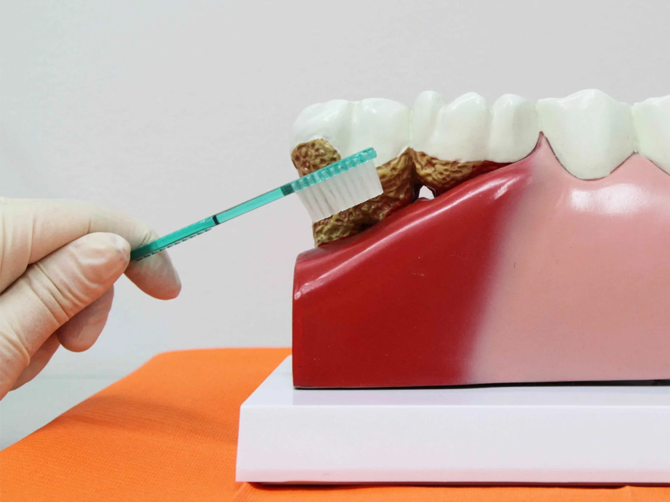 pulizia dei denti pavia cava manara