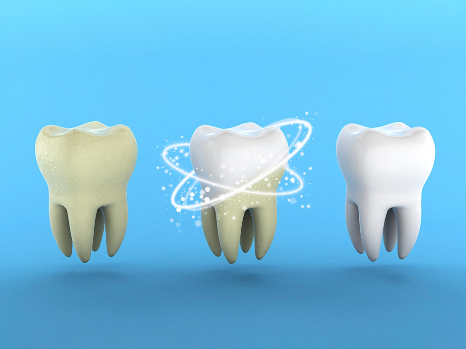 pulizia dei denti pavia cava manara