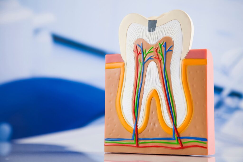devitalizzazione dente